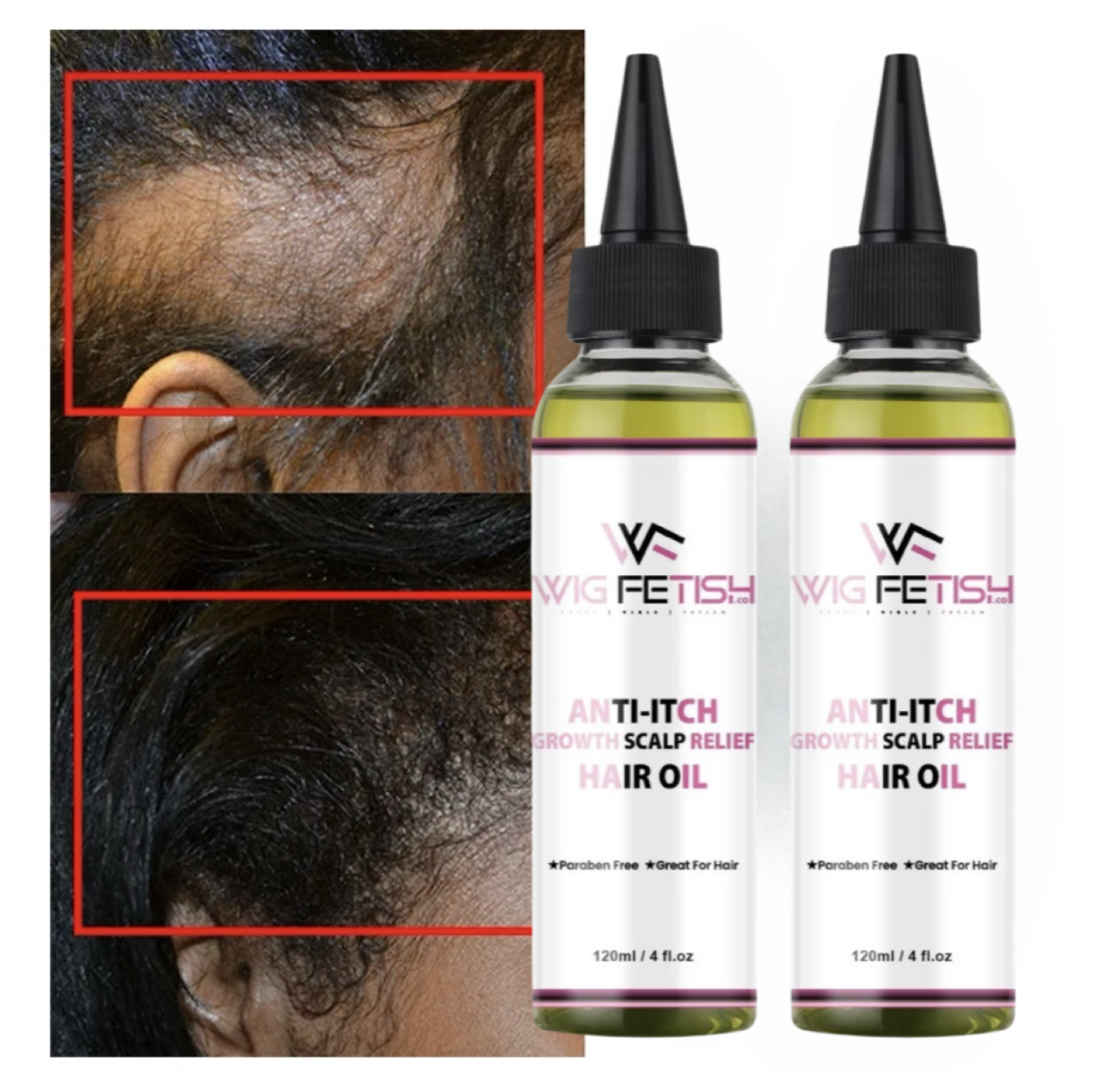 100% ALL NATURAL VEGAN Anti-Itch Growth Scalp Relief Hair Oil 4oz